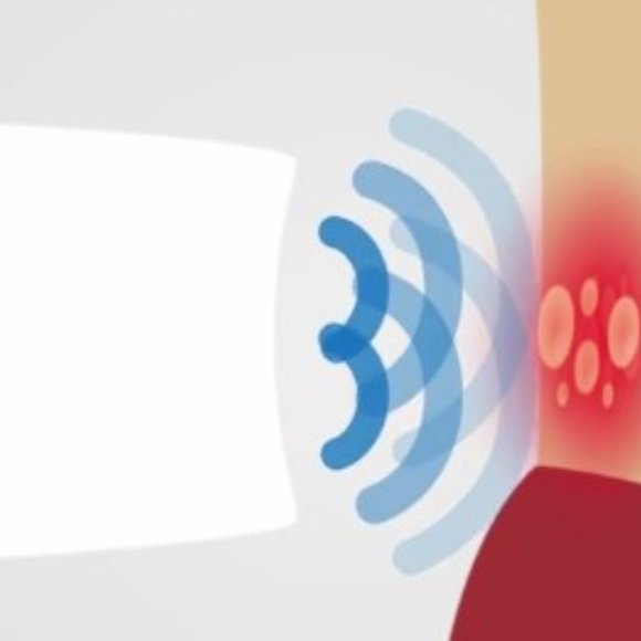 Virulite The Only FDA Approved Cold Sore Treatment Device - Picture 13 of 17